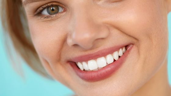 How Do Dental Veneers Work? Understanding the Process