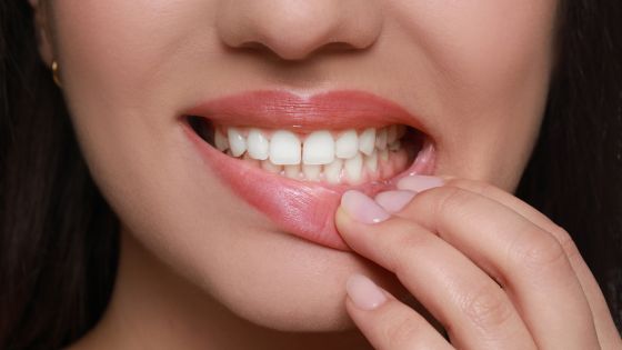 Treating Gum Disease in St. Pete